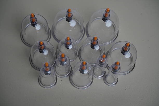 Professional Hijama in Dubai