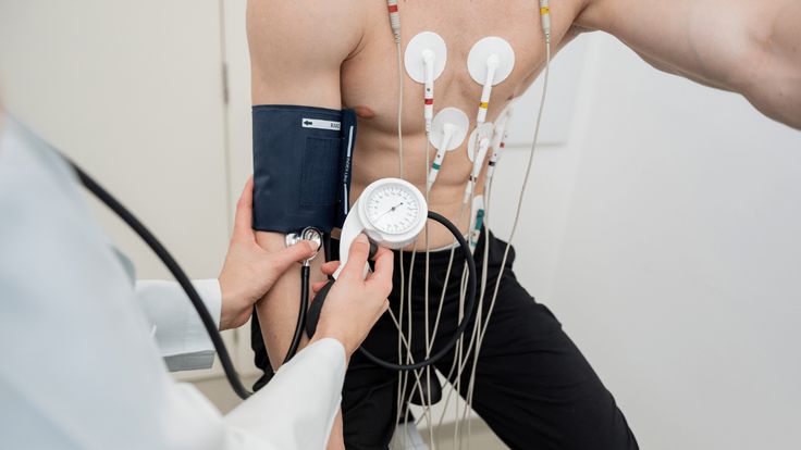 ECG Test