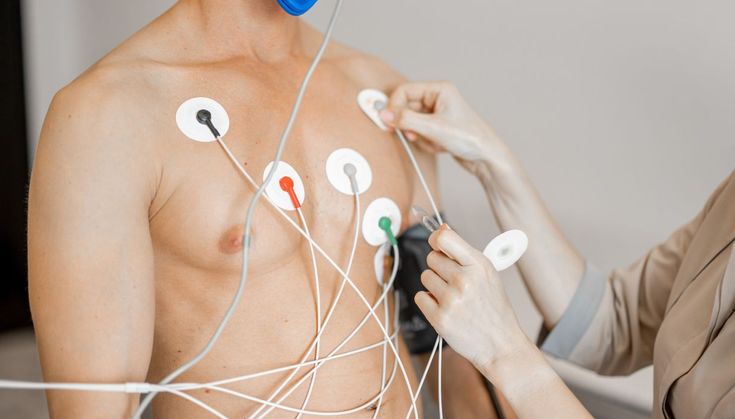 ECG Test
