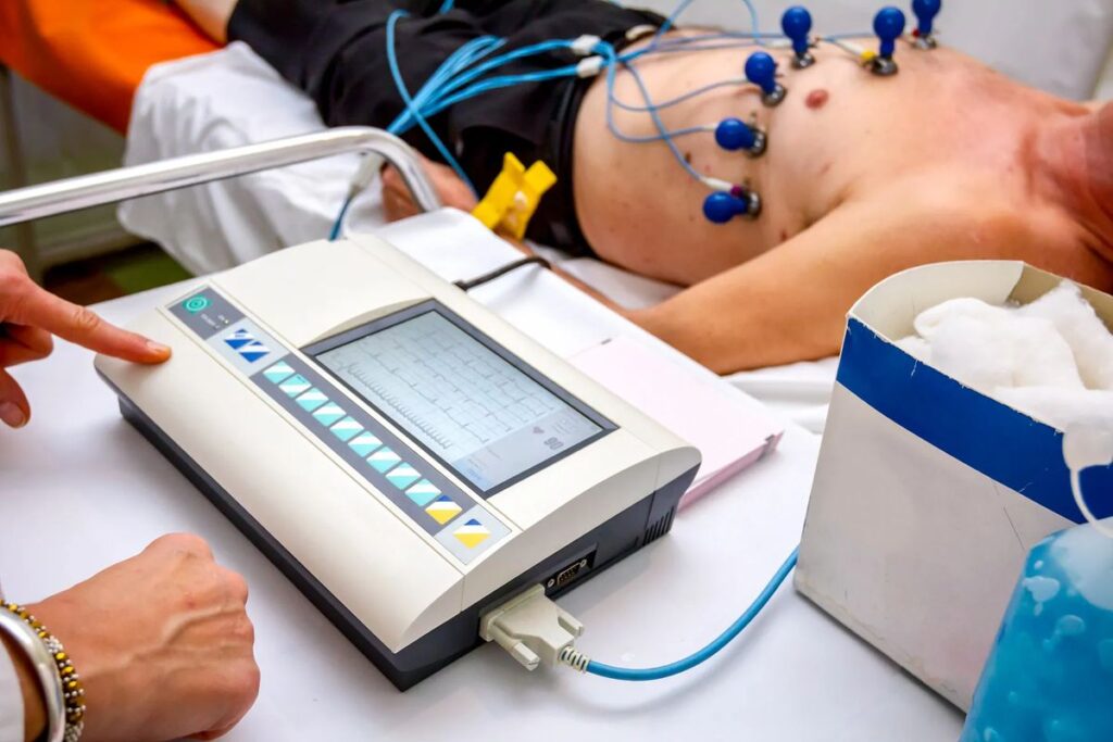 ECG Test