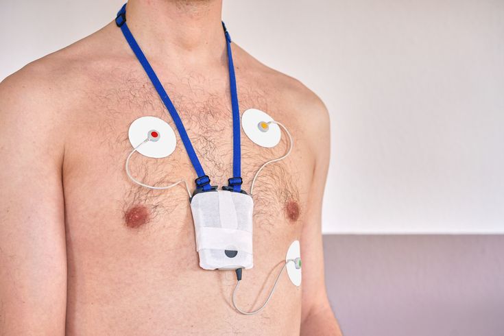 ECG Test