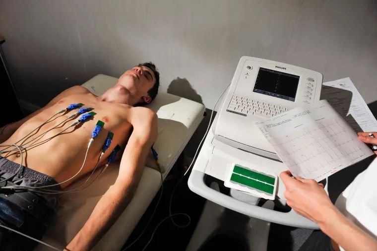 ECG Test