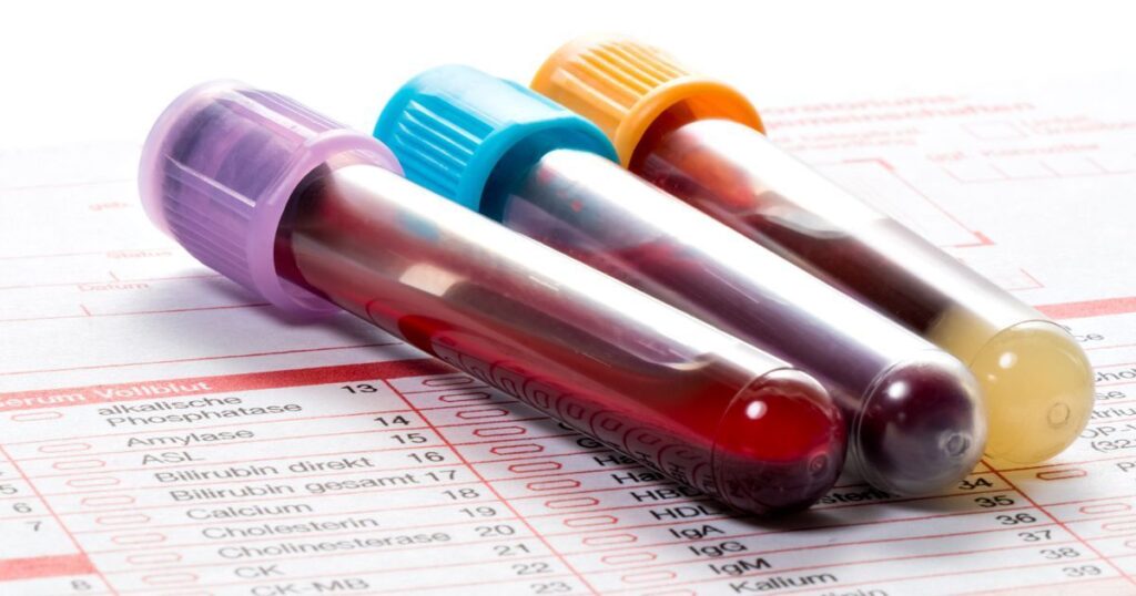 Hormone Tests