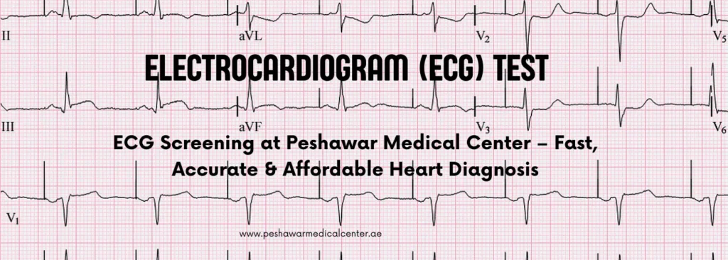 ECG Test in Dubai