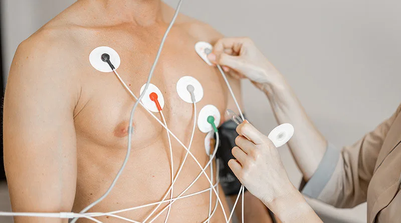ECG Test in Dubai