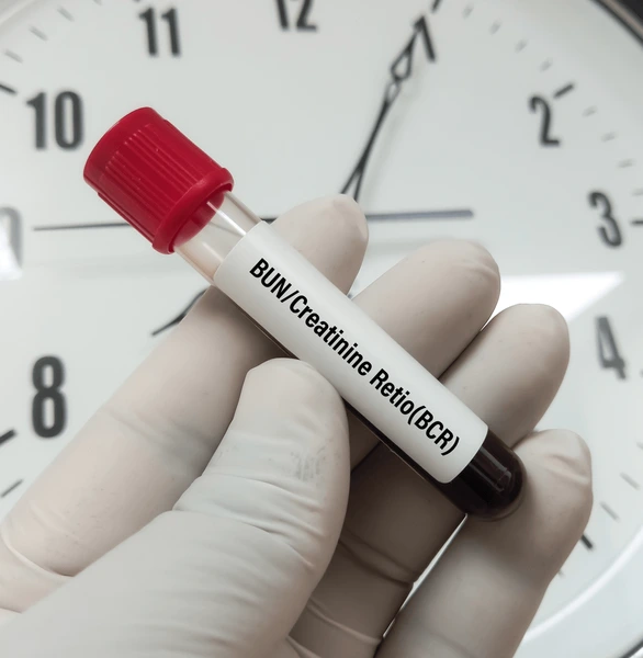 BUN/Creatinine Ratio