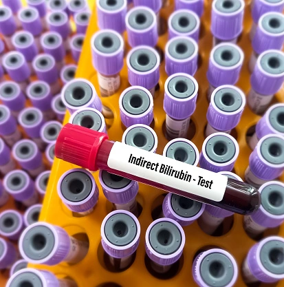 Bilirubin Indirect