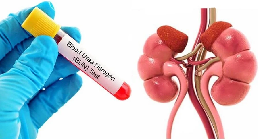 Blood Urea Nitrogen (BUN)