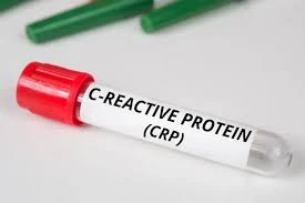 CRP (C-Reactive Protein)