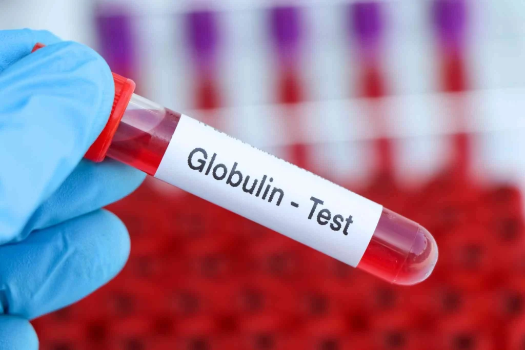 Globulin