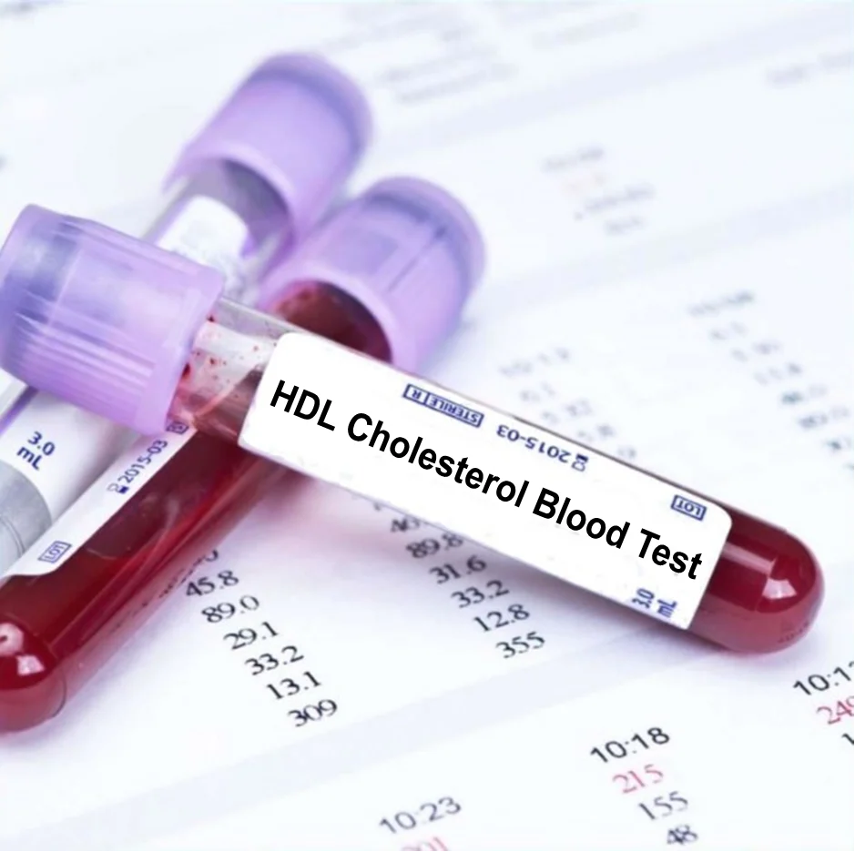 HDL Cholesterol