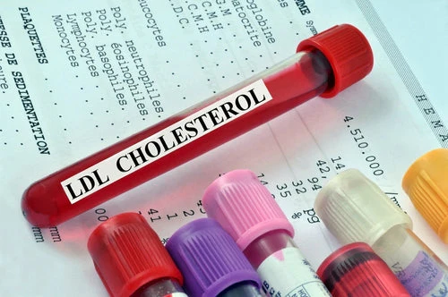 LDL Cholesterol