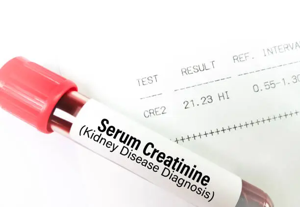 Serum Creatinine