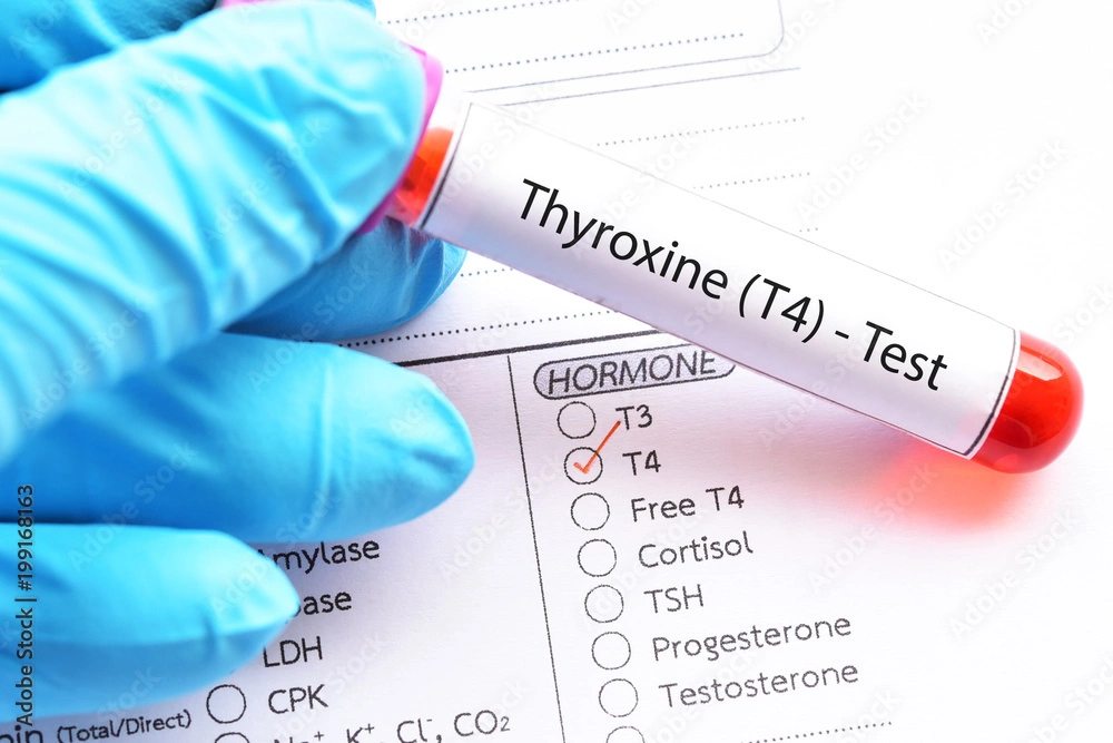 Thyroxine (T4)
