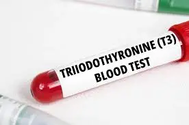 Triiodothyronine (T3)