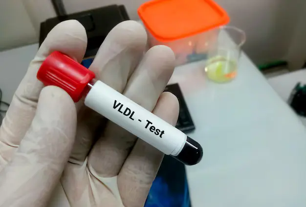 VLDL Cholesterol
