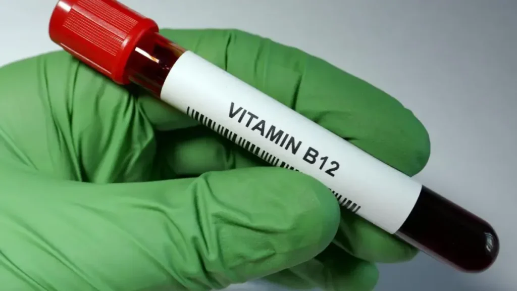 Vitamin B12 (V-B12)