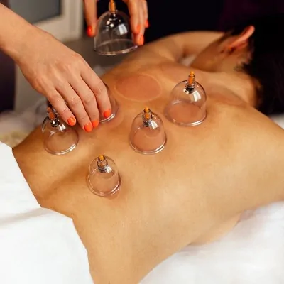Hijama Therapy in Dubai