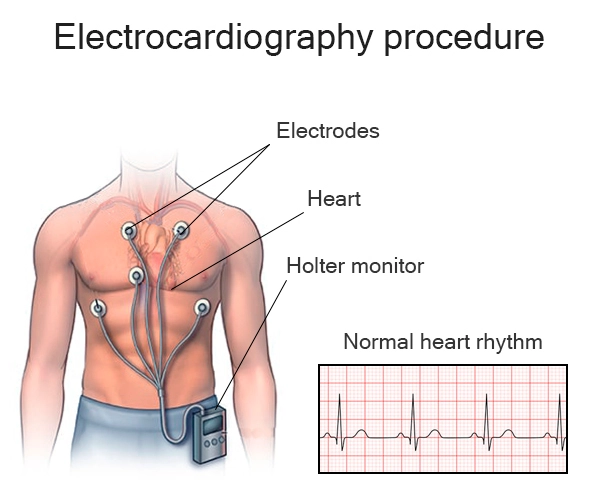 heart ECG test in Dubai