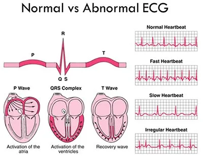 heart ECG test in Dubai