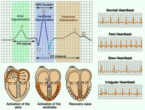 heart ECG test in Dubai