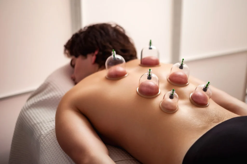 Best Hijama center in Dubai