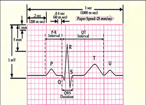 ECG test report