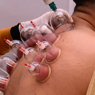 Best Hijama center in Dubai
