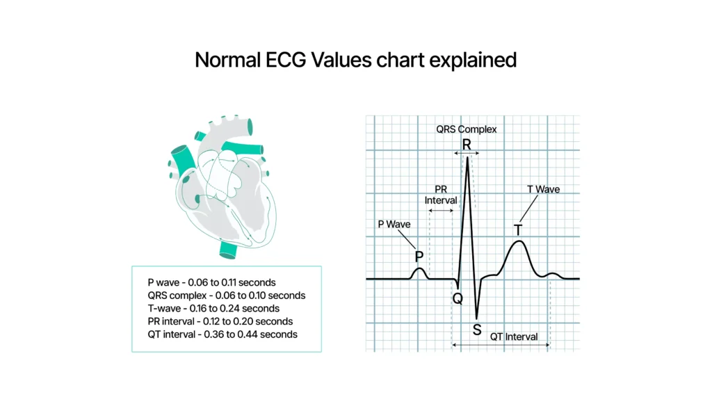 ECG test report