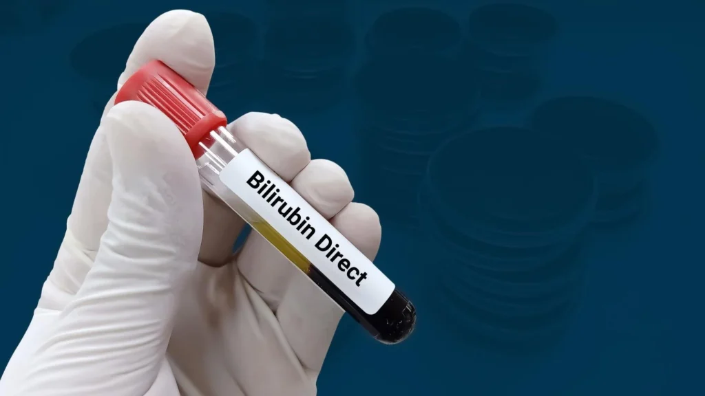 Bilirubin Direct
