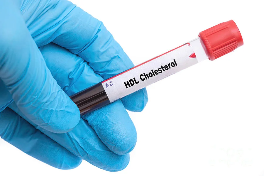 HDL Cholesterol