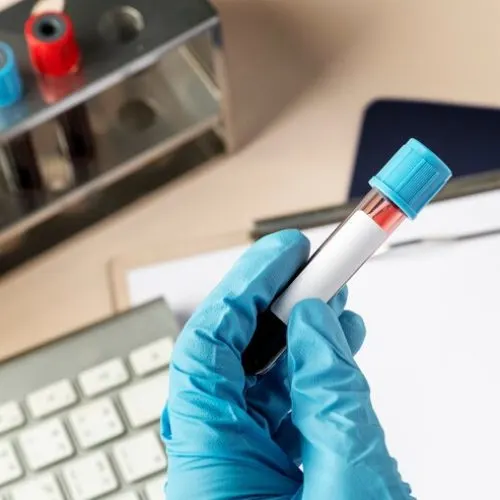 Affordable Lab Tests Dubai