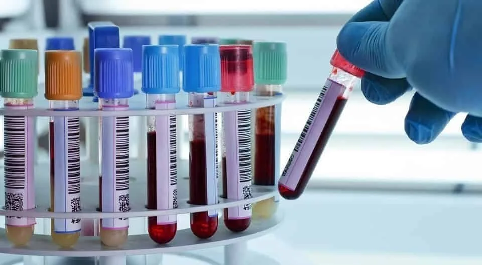 Diagnostic laboratory testing in Dubai for healthcare evaluation