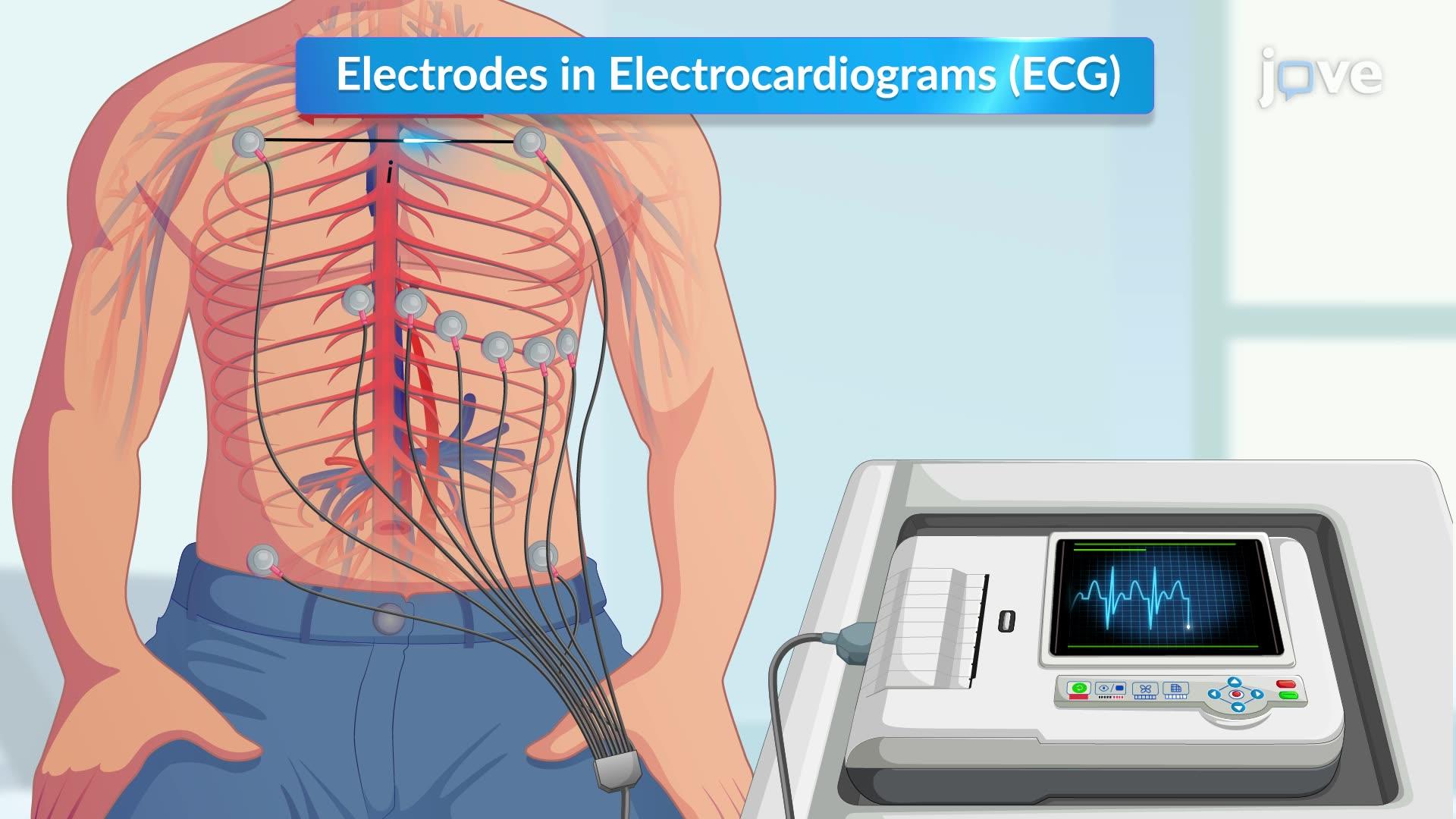 ECG test electrodes recording the electrical activity of the heart